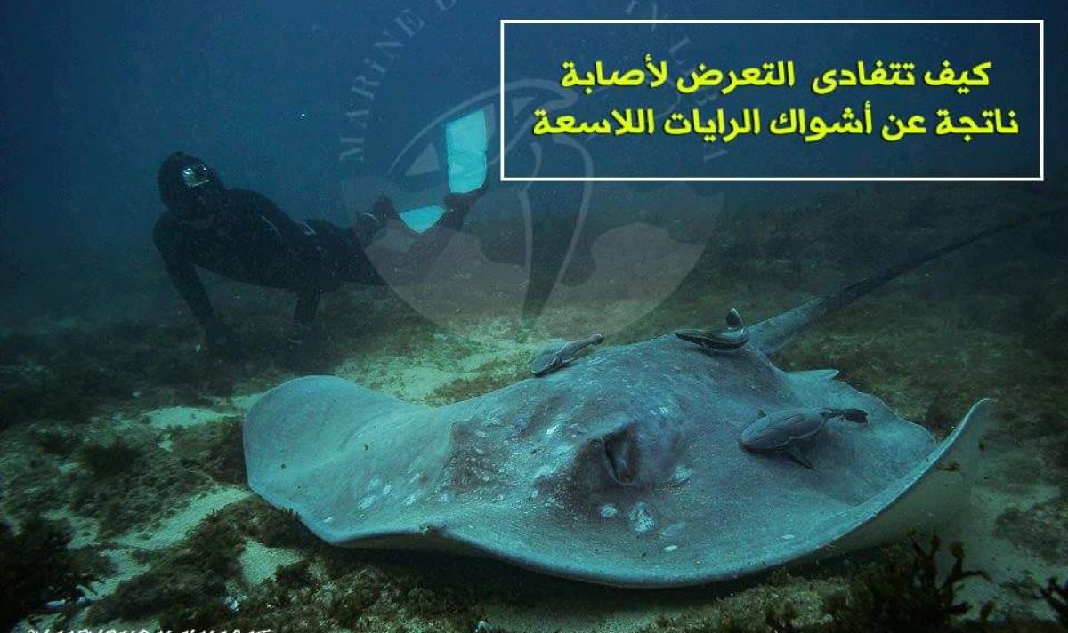 كيف تتفادى التعرض لإصابة من الرايات اللاسعة ؟ 3 received 2242048112607260 7eab3bfe
